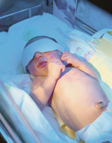 การฝันของทารก