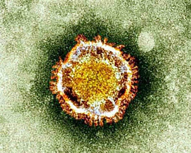 ไวรัสโคโรน่า เมอร์ส
