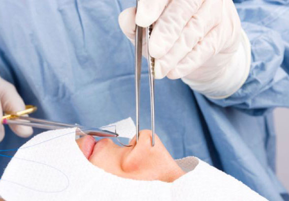 ถ้าเสริมจมูกแล้วจะช่วยให้ใบหน้าดูมีมิติขึ้นไหม