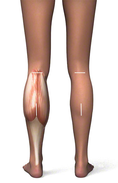 ลดน่องปูด น่องโต โชว์ขาเรียว Calf Muscle Reduction