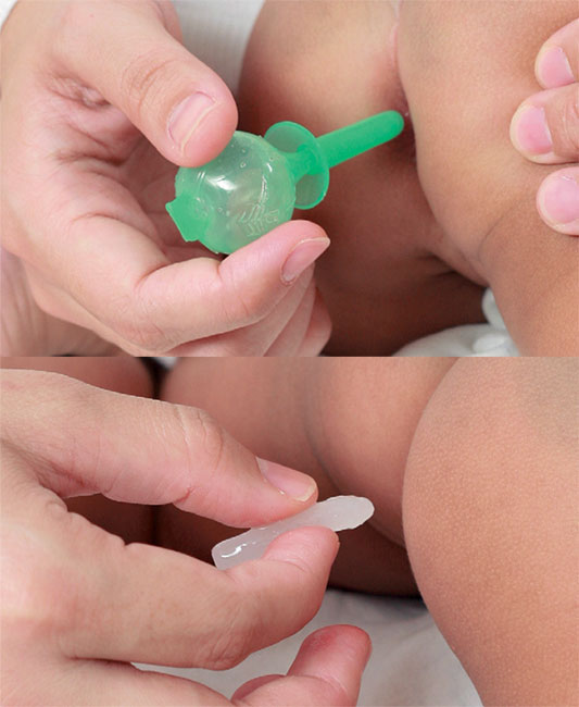 สวนทวารลูกน้อย ทารกอายุ 9-8 เดือน