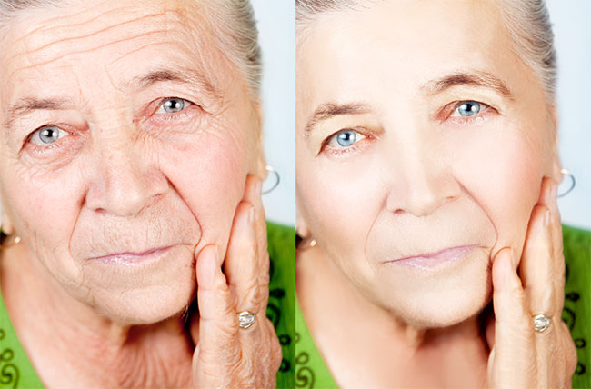 ใต้ตาแก่ แก้ให้ถูกที่