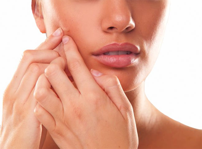 ปัญหารอยแดงจากสิว รักษาอย่างไรดี