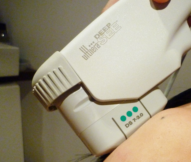 Ulthera และ Thermage ยกกระชับผิวหน้าแตกต่างกันอย่างไร