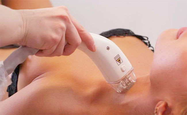 ความร้อนสูงระหว่างทำ Ultrasound ส่งผลอันตรายต่อคนไข้