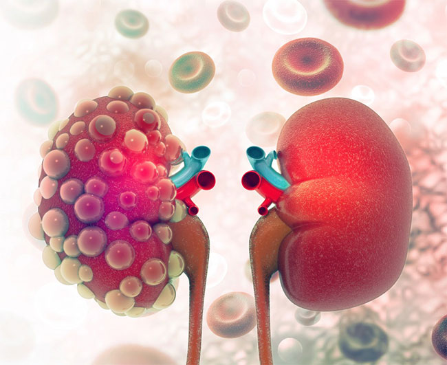 เบาหวานความดันเลือดสูงไขมันในเลือดสูงน่ากลัวตรงไหน