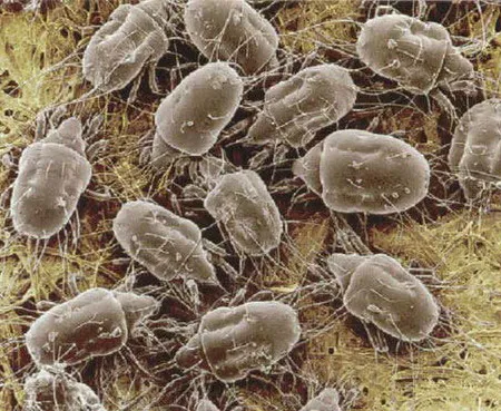 ไรฝุ่น สิ่งที่เลี่ยงไม่ได้ แต่ป้องกันได้