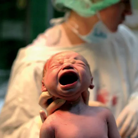 ผ่าตัดคลอดกับคลอดธรรมชาติวิธีไหนดีกว่า