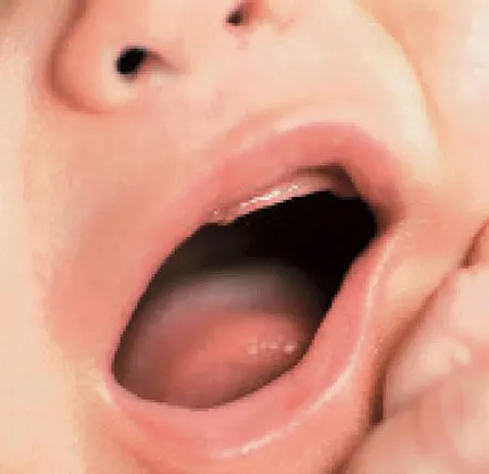 วิธีเช็ดช่องปากลูกน้อย