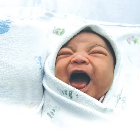 Newborn Skin ผิวหนังของทารกแรกเกิด