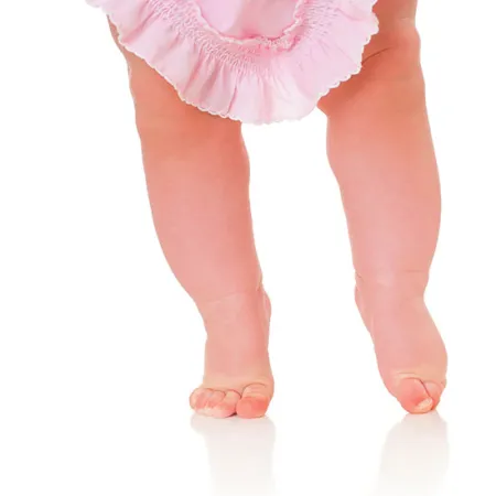 เอ๊ะ ลูกเราขาโก่งหรือเปล่าน๊า ตอน 2