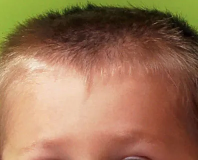 การเจริญเติบโตของสมอง