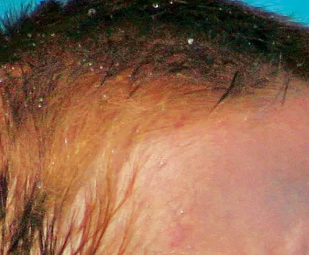 ขั้นตอนการเจริญเติบโตและพัฒนาการของระบบประสาท