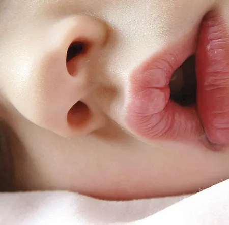 หอบหืดในเด็ก การรักษาโรคหอบหืด