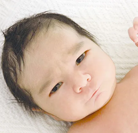 ลูกจ๋าทำไมตาแฉะ Sticky Eye