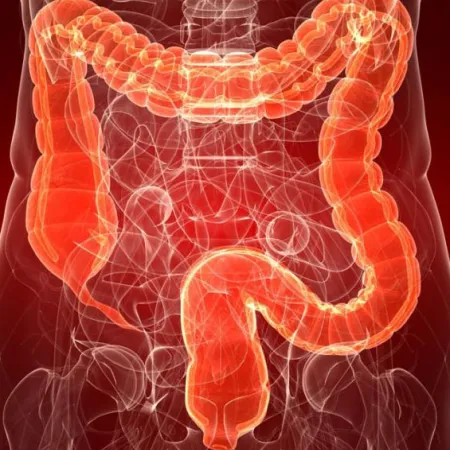 การตรวจคัดกรอง สามารถลดมะเร็งลำไส้ใหญ่ได้ 30%