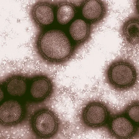 โรคสุดฮิตช่วงหน้าร้อน