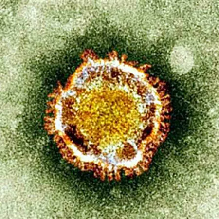 ไวรัสโคโรน่า เมอร์ส