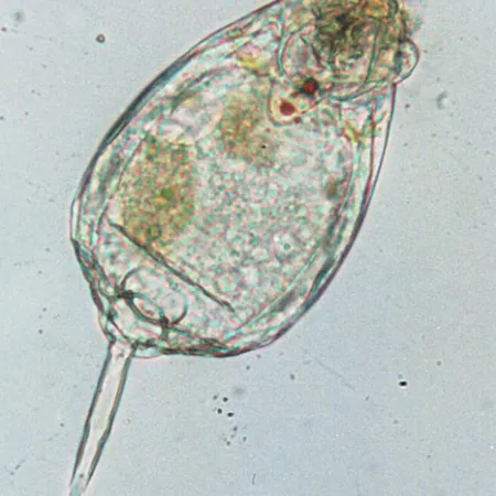 เตือนภัย โปรโตซัวตัวร้าย