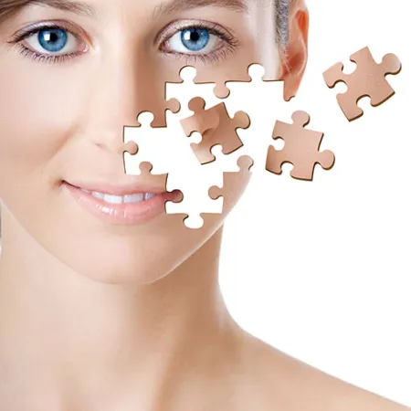 หลากหลายวิธี การแก้ไขโครงหน้า ตอนที่ 1 V shape