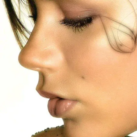 Crystal Face Lift สุดยอดนวัตกรรมยกกระชับ
