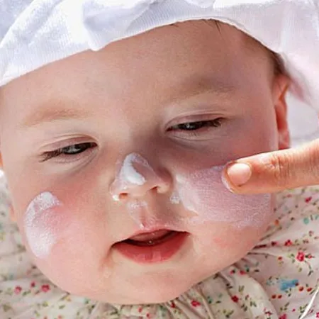 เมื่อหนู เป็นผื่นลมพิษ Rash Attack