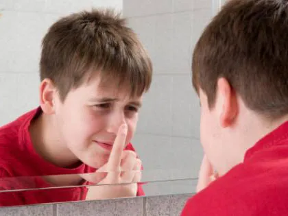 ผิวหน้าแพ้ง่าย พอจะมีทางอื่นที่จะรักษาสิวและรอยสิวบ้างไหม