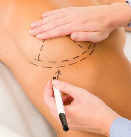 การเสริมหน้าอกให้อิ๋มและใหญ่ ดูมีเสน่ห์เย้ายวน