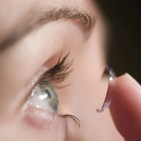 คอนแทคเลนส์ บิ๊กอาย สวยเสี่ยงภัย