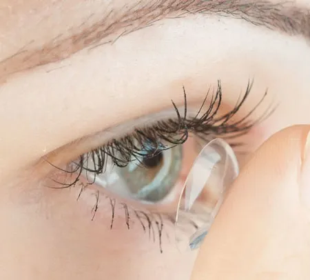 การดูแลรักษา เลนส์สัมผัส