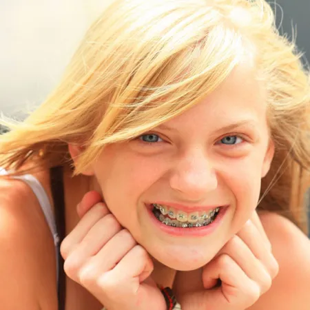 จัดฟันแฟชั่นไม่มีผลดีอันตรายต่อฟันและอวัยวะอื่น