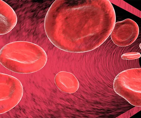 ภาวะเลือดจาง จากการขาดธาตุเหล็ก