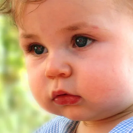 ปฐมพยาบาลเจ้าตัวเล็กวัยหัดคลานปากแตก