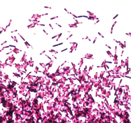 พิษโบทูลินั่ม โรคโบทูลิซึ่ม