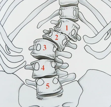 กระดูกสันหลังคด