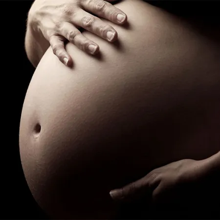 ป้องกันรอยแตกลายตั้งแต่ก่อนตั้งครรภ์