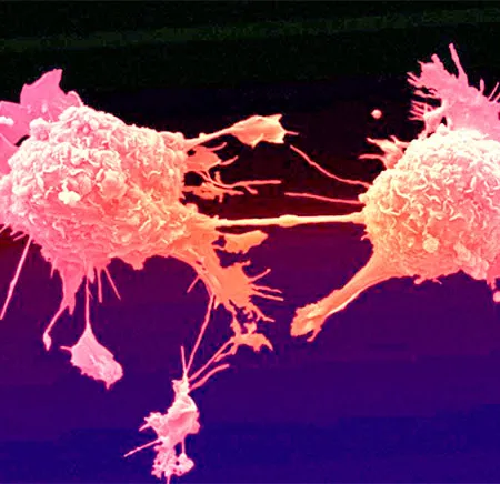 ยีนเปลี่ยนแปลงเสี่ยงมะเร็งเม็ดเลือด