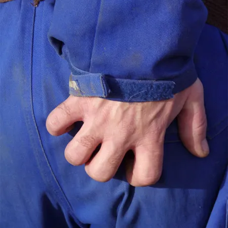 คัน อย่าแก้แค่เกา