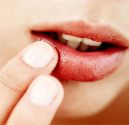 สัญญาณเตือนก่อนเชื้อเริมบุก