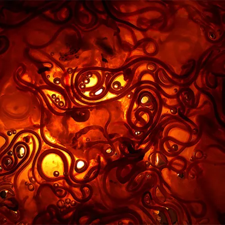 พยาธิ ป้องกันได้