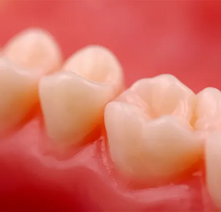 เจ้าตัวเล็กฟันมีคราบเหลืองดำทำอย่างไรดี