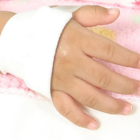 วิธีปฐมพยาบาลเบื้องต้นเด็กจากบาดแผลไฟไหม้