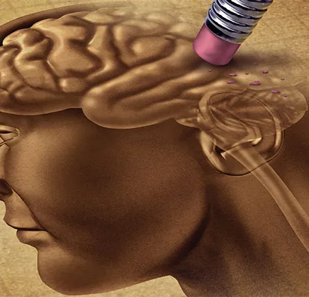 ความจำเสื่อม เสี่ยงหัวใจล้มเหลวกำเริบ