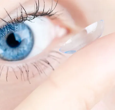 คอนแทคเลนส์ รักษาโรคจอประสาทตาเสื่อม