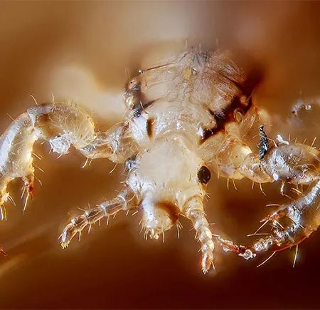 เหาและไข่เหา วิธีกำจัดเหา