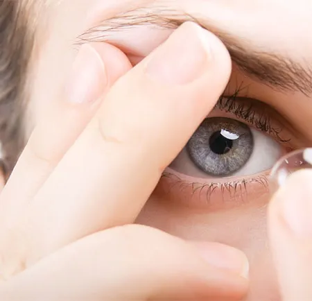 เสริมสวยดวงตาด้วย คอนแทคเลนส์ ระวังตาบอด