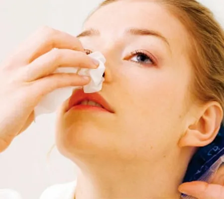 เลือดกำเดาไหล จากผนังกั้นช่องจมูกคด