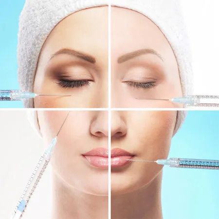 ฉีดฟิลเลอร์แบบ Subperiosteal Injection with Blunt Cannula แตกต่างจากการฉีดฟิลเลอร์ทั่วไปอย่างไร