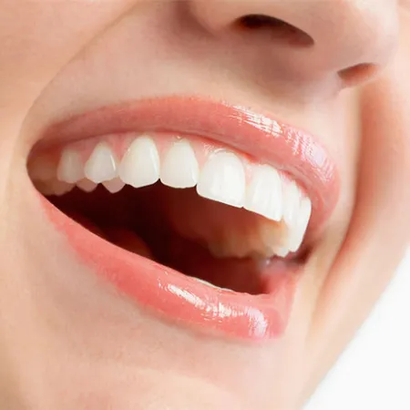 วิธีการรักษาปัญหายิ้มเห็นเหงือก