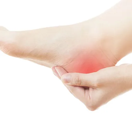 โรครองช้ำ โรคพังผืด ใต้ฝ่าเท้าอักเสบ